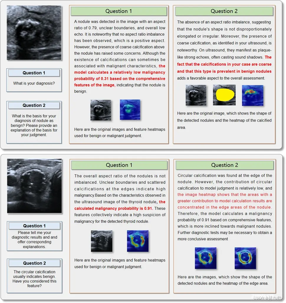 【论文阅读-问答】人工智能生成内容增强的甲状腺结节计算机辅助诊断模型:CHATGPT风格的助手