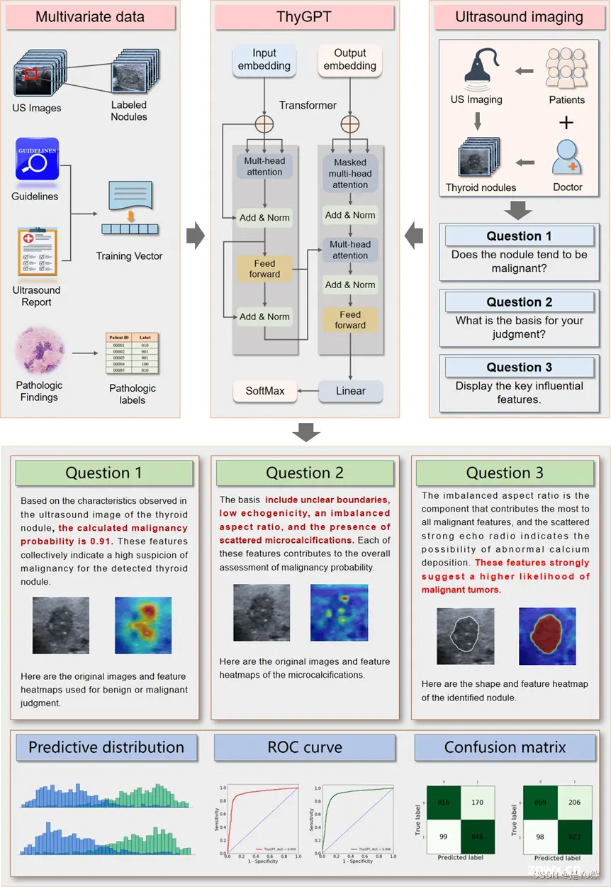 Figure 1: 甲状腺结节的ThyGPT模型的总体设计。