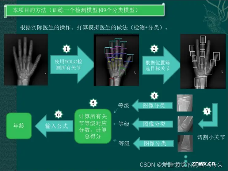 【人工智能学习之骨龄检测实战】